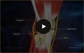 Genicular Nerve Block - Video Picture