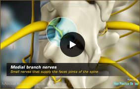 Medial Branch Block Injections - Video Picture