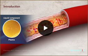 Platelet Rich Plasma Injection (PRP) - Video Picture