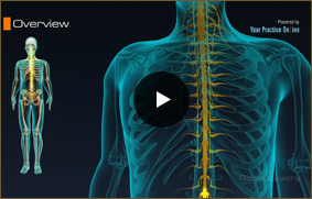 Radiculopathy - Video Picture