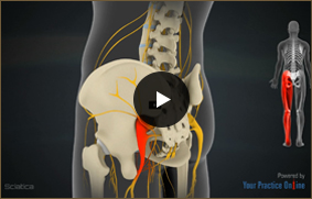 Sciatica - Video Picture