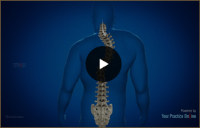Scoliosis - Video Picture