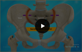 SI Joint Pain - Video Picture