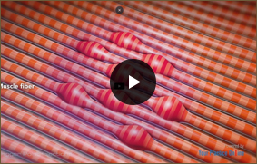 Trigger Point Injections - Video Picture