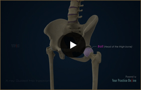 X-ray Guided Hip Injections - Video Picture