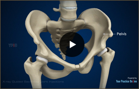 X-ray Guided Sacroiliac Joint Injections - Video Picture