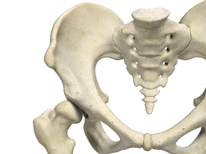 Developmental Dysplasia pic
