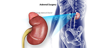 Adrenal Surgery icon
