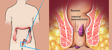 Anorectal Surgery icon