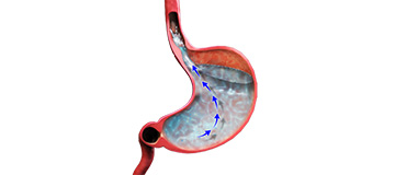 Digestive Disorders icon