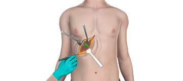 Gallbladder Disease icon