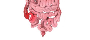 Inflammatory Bowel Disease icon