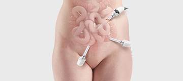 Laparoscopic Colorectal Surgery icon