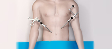 Minimally Invasive  Surgery icon