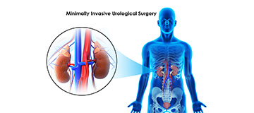 Minimally Invasive Urological Surgery icon