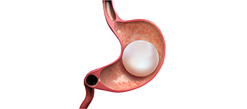 Orbera Managed Weight Loss System icon