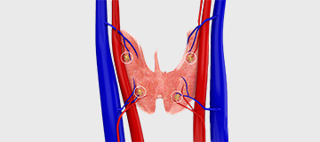 Parathyroid Surgery icon