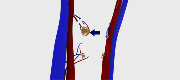 Parathyroidectomy icon