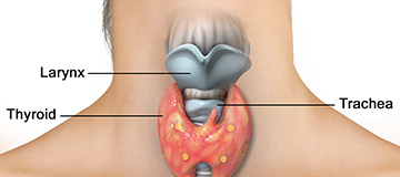 Thyroid Disorders icon