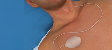 Thyroid Surgery icon