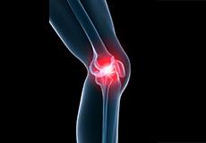 Picture of Knee Pain