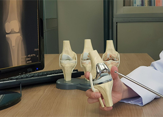 The ElyMethod™: A Complete Approach to Knee Replacement- Before, During, and after Surgery