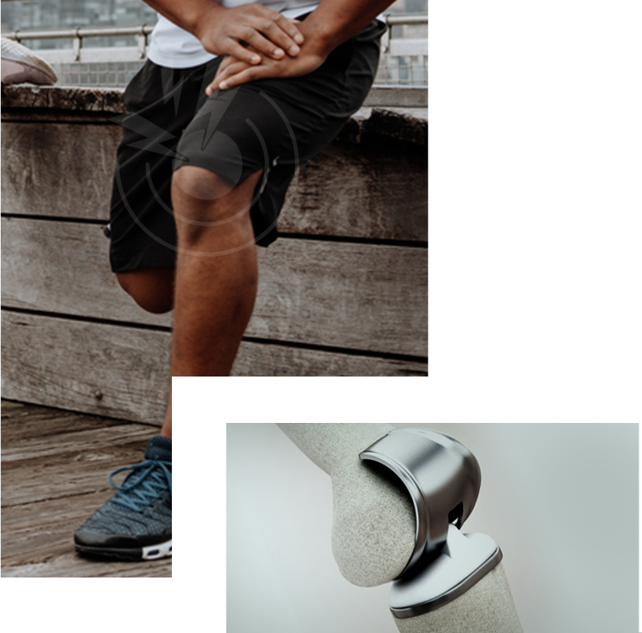 Knee Replacement Img