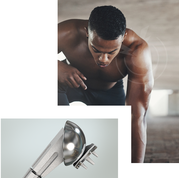 Shoulder Replacement Img