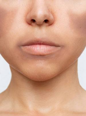 Skin pigmentation pic