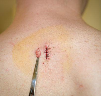 Surgical Dermatology