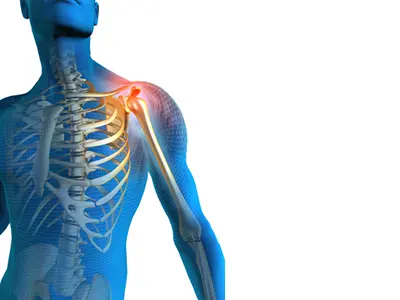 Shoulder Pain Images