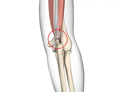 Triceps Injuries Images