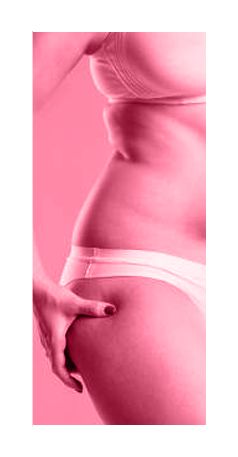 Body Contouring Surgery Small Picture