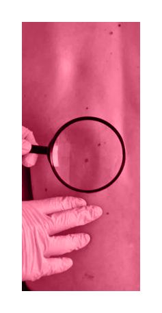 Skin Surgery Small Picture