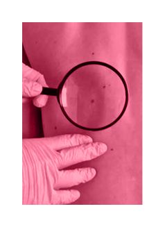 Skin Surgery Small Picture