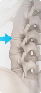 Advanced Surgical Approach - image