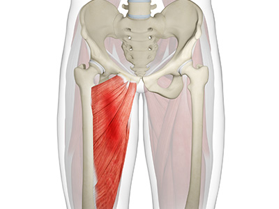 Groin Strain - Educational Picture