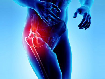 Hip Pain - Educational Picture