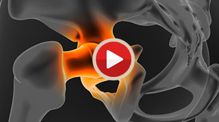 Patient Education Videos img