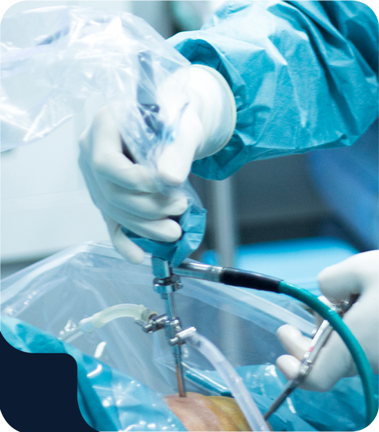 Minimally Invasive Knee Arthroscopy - Educational Picture