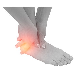 Foot and Ankle Sports Injuries pic