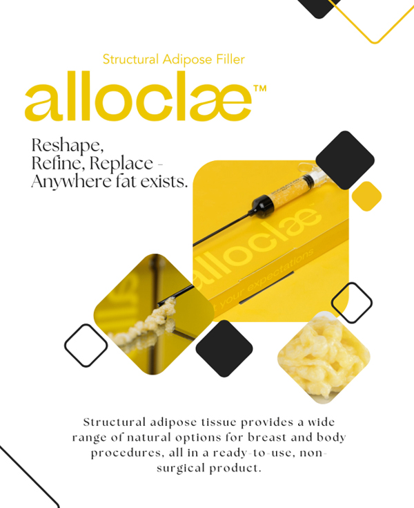 alloClae - image 3