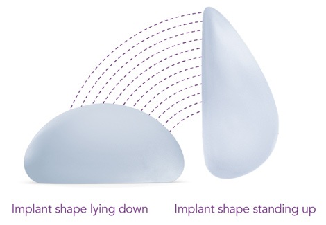 Picture of Motiva Smooth Silk Ergonomix