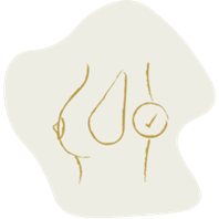 Picture of Breast Stability
