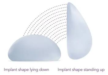 Picture of Implant Shape