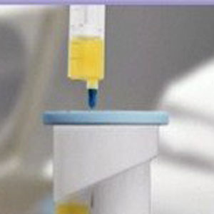 Platelet-Rich Plasma (PRP) Injection - Educational Photo