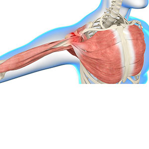 Shoulder Impingement - Educational Photo