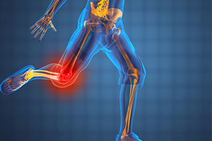 Sports Medicine - Educational Photo