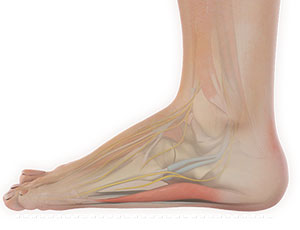 Flatfoot Reconstructions - Educational Photo