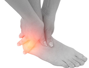 Sports Injuries - Educational Photo